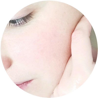 Facial skin
